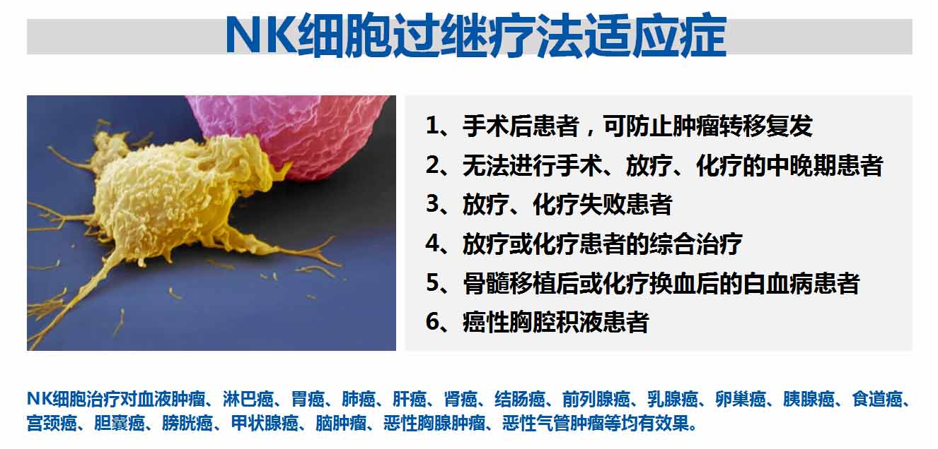 NK细胞过继疗法适应症