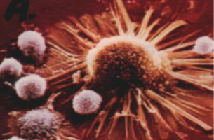 NK细胞免疫疗法