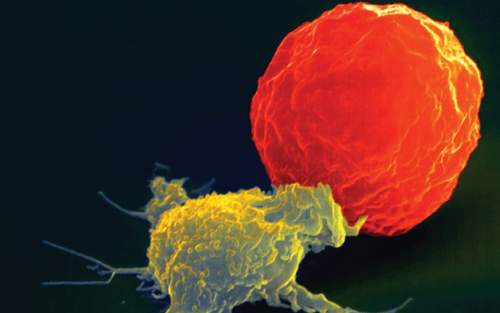 NK细胞过继性免疫疗法