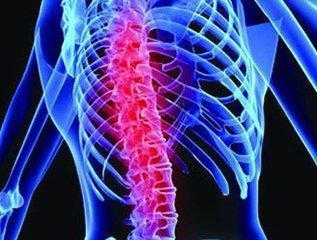 干细胞移植治疗脊髓损伤临床研究进展