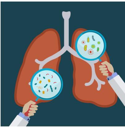 NK细胞免疫疗法治疗肺癌最新研究   