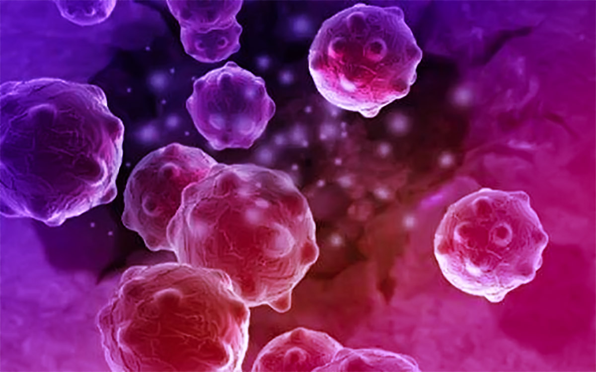 NK细胞免疫疗法