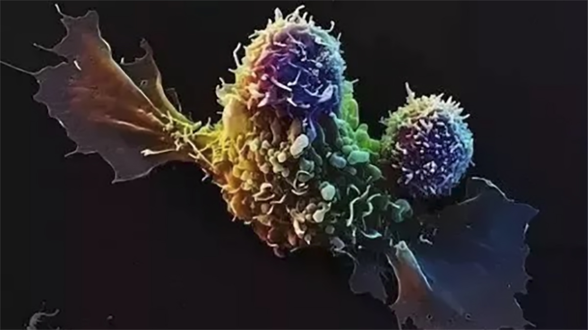 NK细胞免疫疗法现状很乐观，有望治愈更多的癌症患者