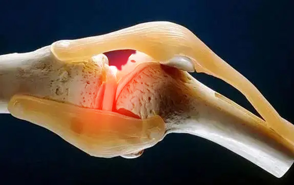 干细胞在骨关节炎软骨损伤中的临床应用