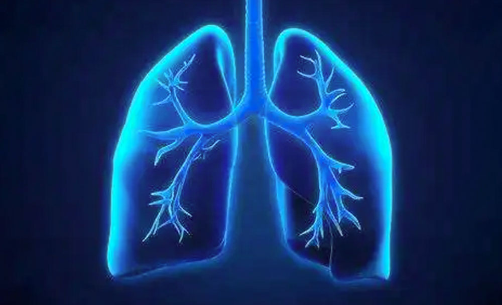 特发性肺纤维化