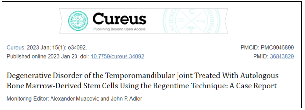Cureus期刊最新报道：干细胞治疗1例下颌关节退行性疾病，随访显示完全康复