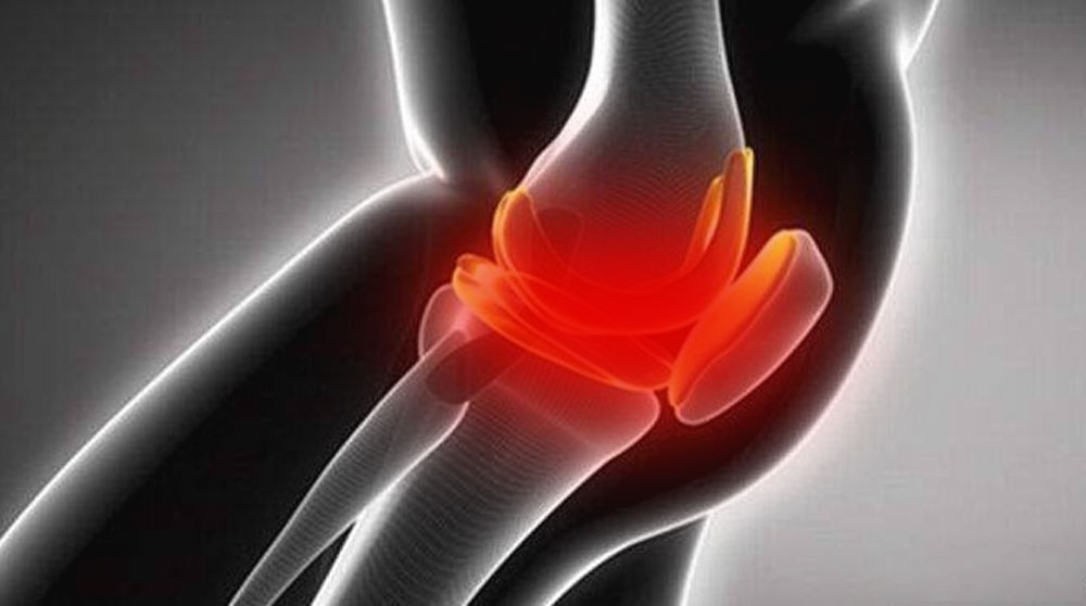 首例长达4年的随访报告 | 骨髓来源MSCs治疗重度膝骨关节炎，成功率高达95%，步行距离显著改善