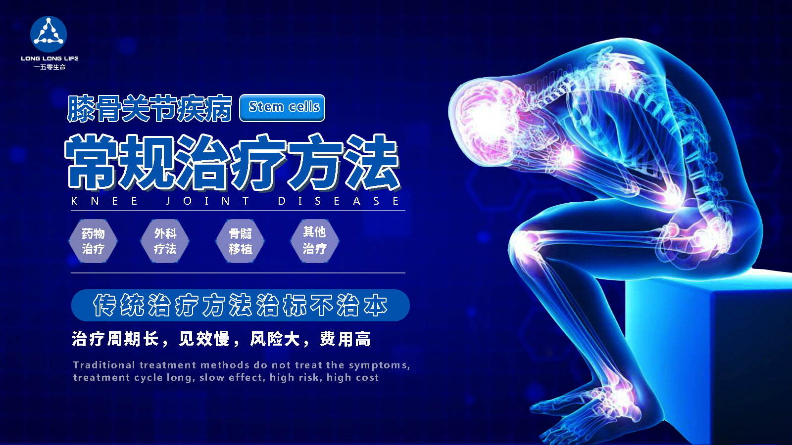 膝关节炎病,150生命