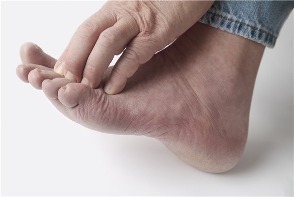 干细胞疗法治疗糖尿病足最新临床研究