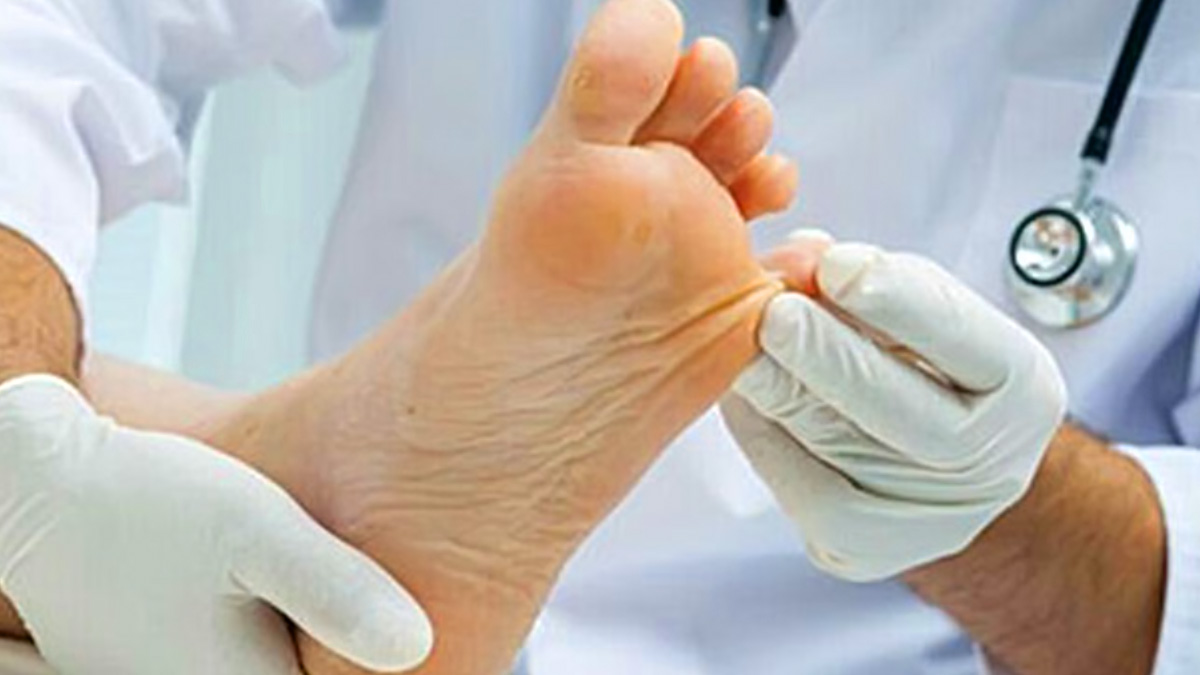 干细胞治疗糖尿病足的临床效果研究