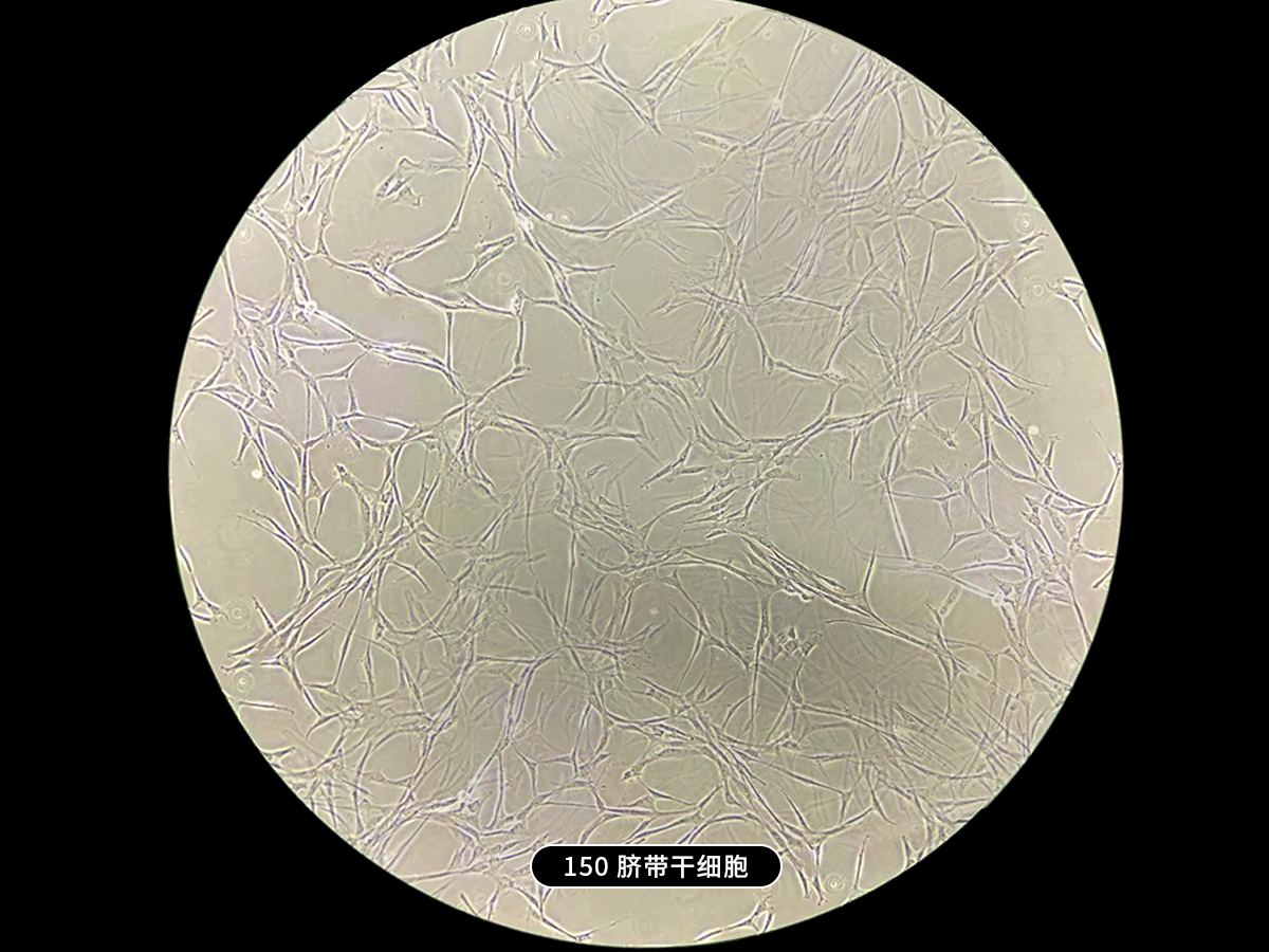 干细胞疗法