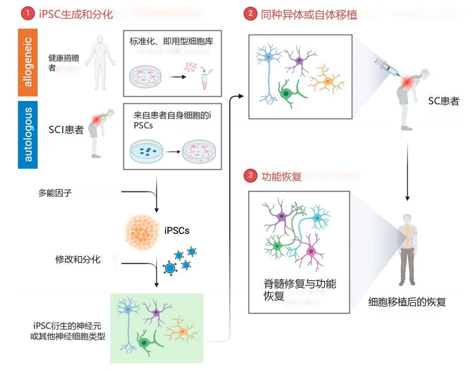 脊髓损伤临床试验