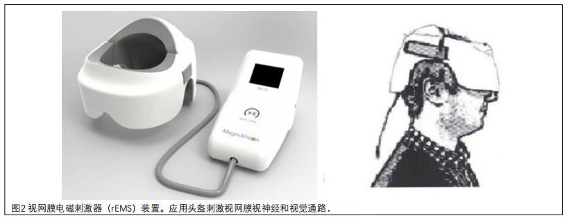 中毒性视神经病变临床试验