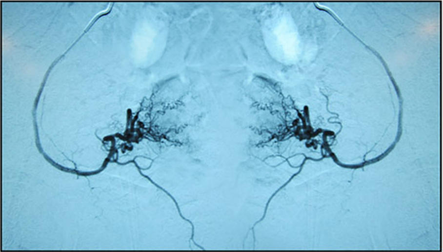 宫腔疾病临床试验