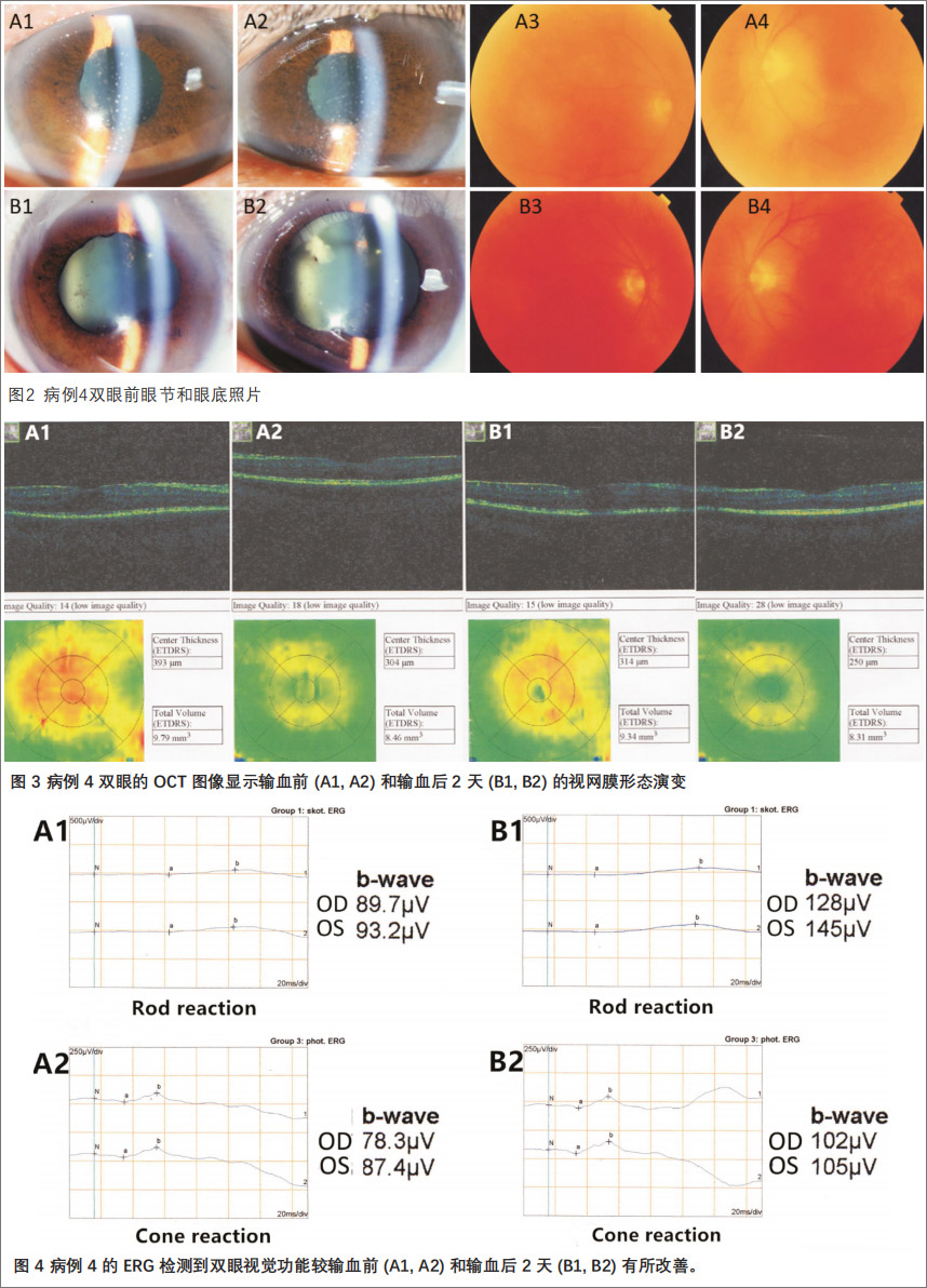 葡萄膜炎临床试验