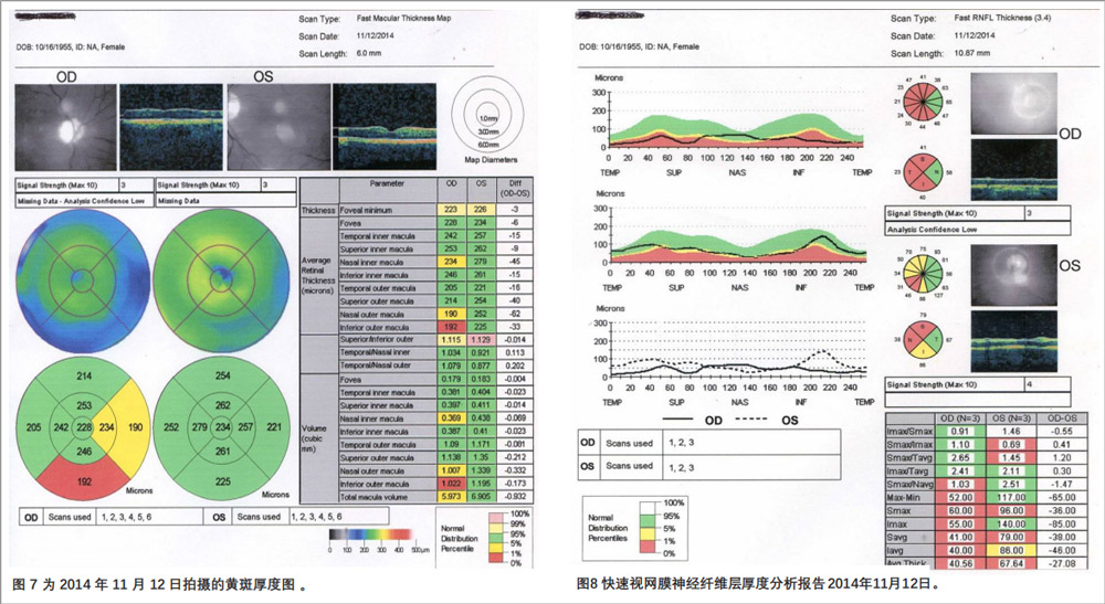复发性视神经病变临床试验