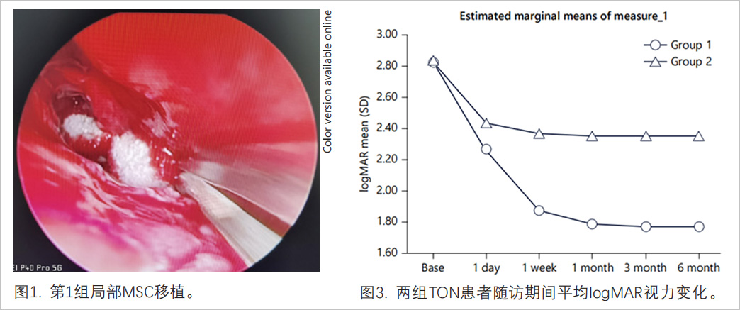 创伤性视神经病变临床试验