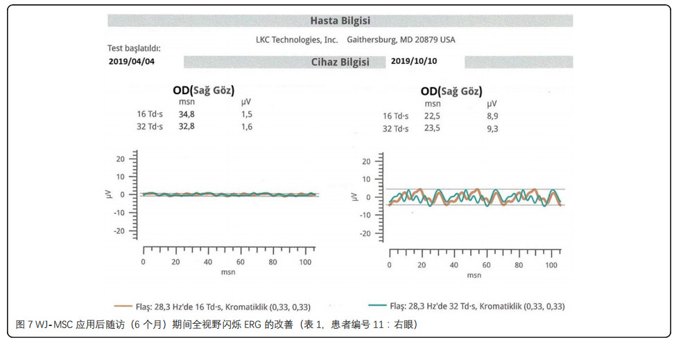 视网膜色素变性临床试验