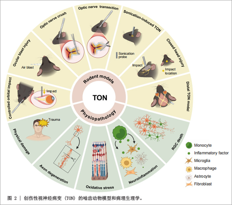 视神经病变研究