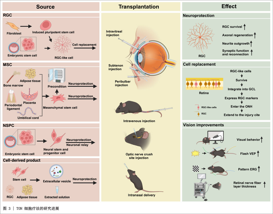 视神经病变研究