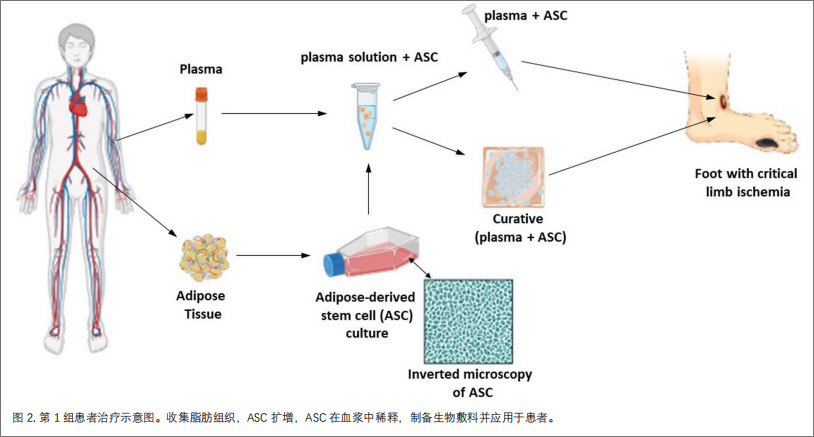 严重肢体缺血临床研究