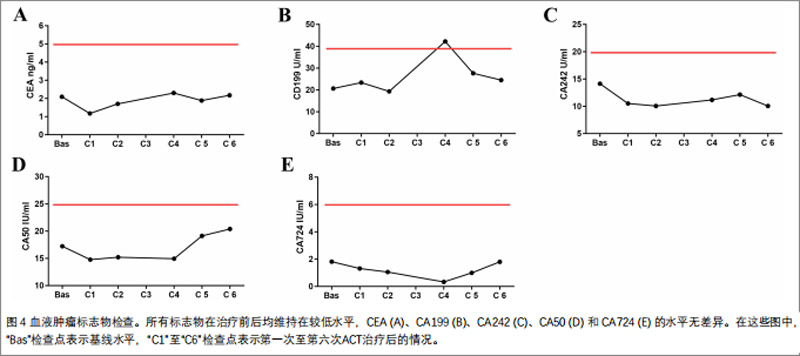 直肠癌临床研究
