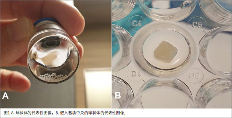 视网膜色素变性临床研究