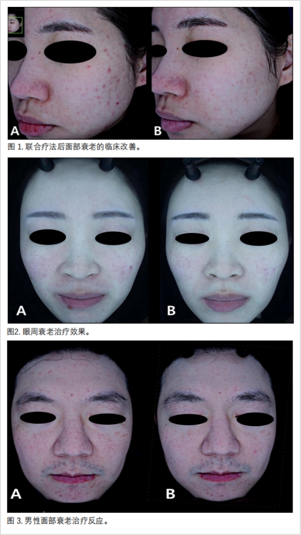 面部抗衰临床研究